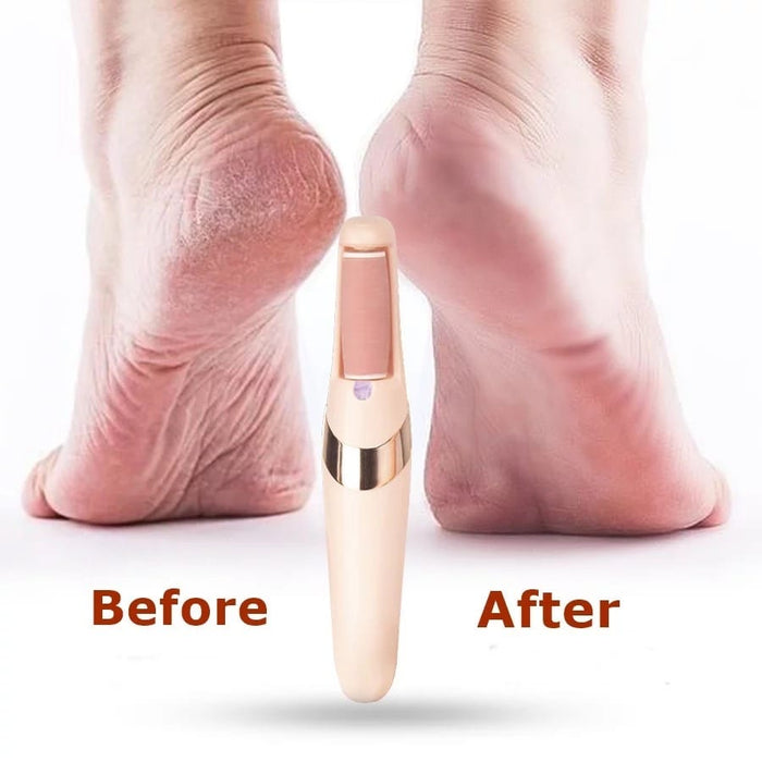 An image displaying a woman's feet, highlighting the visible difference achieved through a foot pedicure using a Portable Electric Pedicure Foot Callus Remover